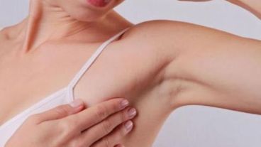 La zona de las axilas es uno de los lugares donde suelen aparecer las lesiones.