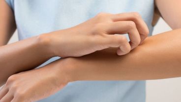 La dermatitis atópica afecta a la función barrera de la piel, aquella encargada de evitar que penetren sustancias que provocan irritaciones.