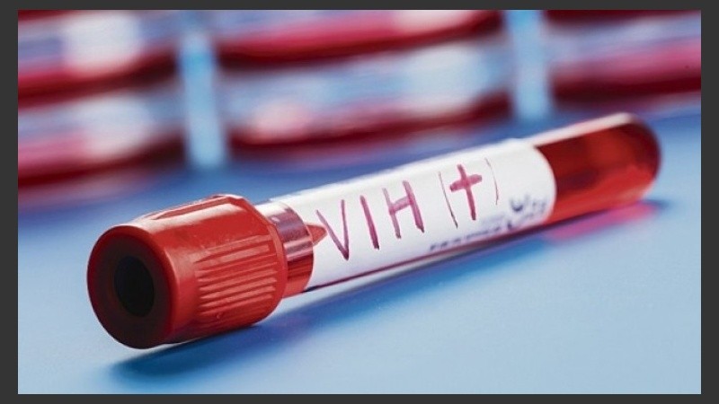 El anticuerpo sería capaz de tratar todas las variedades de VIH.
