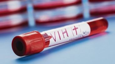 El anticuerpo sería capaz de tratar todas las variedades de VIH.