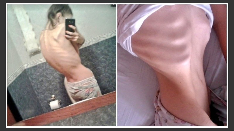 Camila llegó a pesar 38 kilos. 