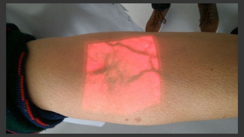 El manejo del AccuVein 400 es de fácil aprendizaje y manejo. 