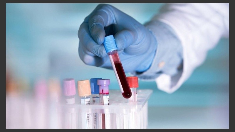 Esta información proporcionada por la prueba de sangre, puede usarse como una medida preventiva para los médicos.