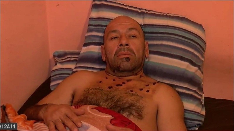 El hombre atacado se recuperaba en la casa.