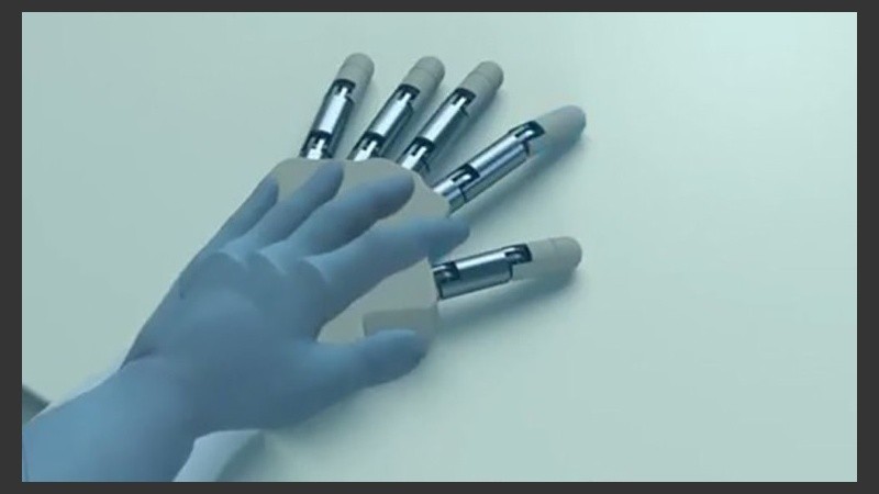 La técnica se basa en incorporar a los amputados con un casco de realidad virtual a través del cual pueden ver una prótesis virtual.