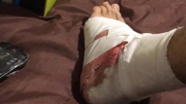 Elian tuvo que ser asistido por la mordedura.