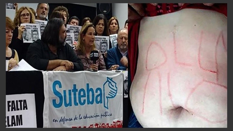 La docente fue agredida en su abdomen. 