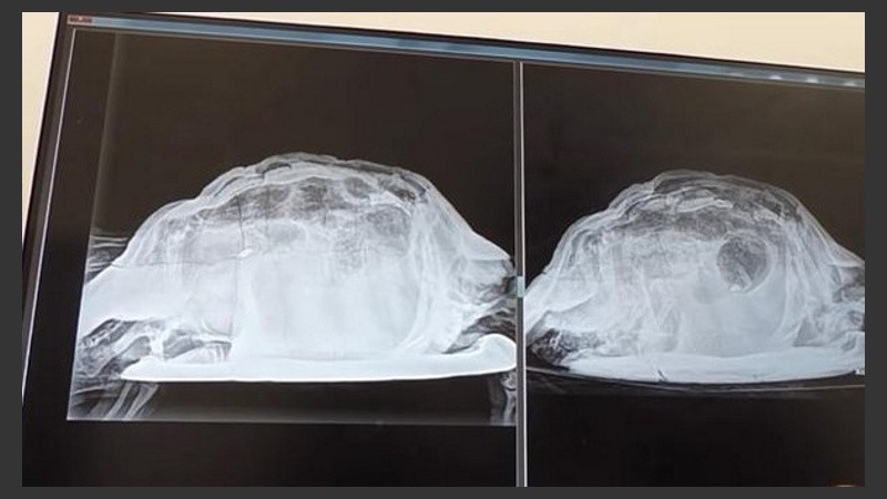 Imágenes de la tortuga en el interior de la mujer.