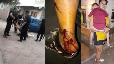 Vecinos denunciaron represión policial en Nuevo Alberdi.