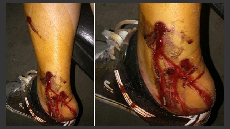 Vecinos denunciaron represión policial en Nuevo Alberdi.