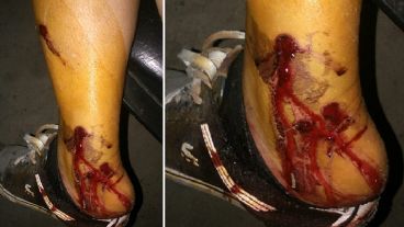 Vecinos denunciaron represión policial en Nuevo Alberdi.