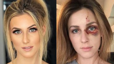 Melissa y un llamado de atención contra los noviazgos violentos.