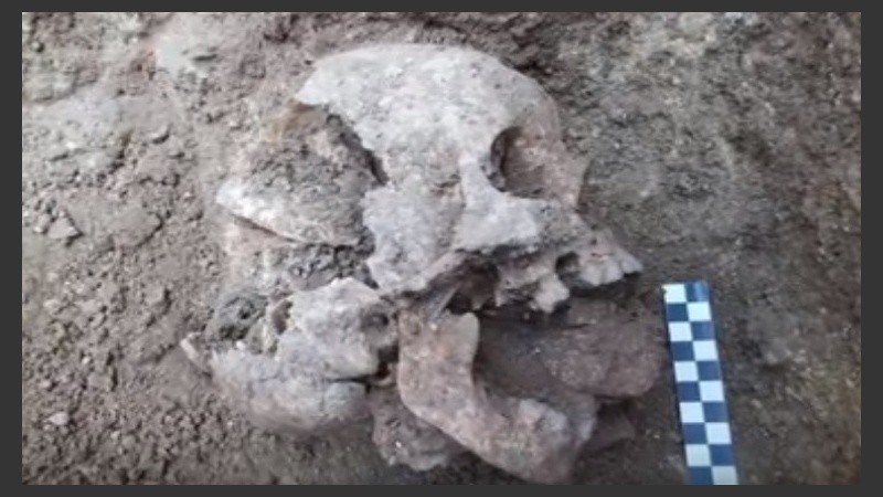 El llamado “vampiro de Lugnano” padecía malaria en el momento de su muerte. Se cree que la piedra en la boca se colocó para evitar que se propagase su enfermedad al resto de la comunidad.