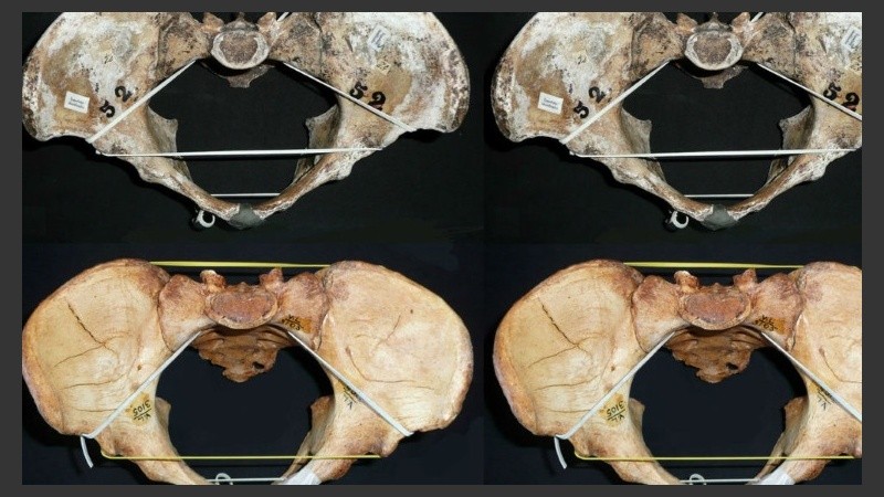 Los canales de nacimiento vienen en una variedad de formas en las mujeres de todo el mundo.