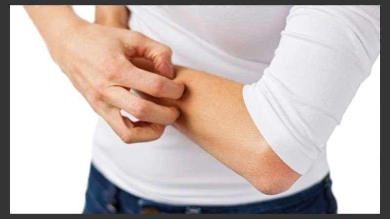 La dermatitis de contacto se puede diagnosticar realizando una prueba mediante un parche cargado con sustancias químicas.