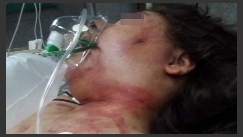 La chica quedó internada en el hospital Vilela.