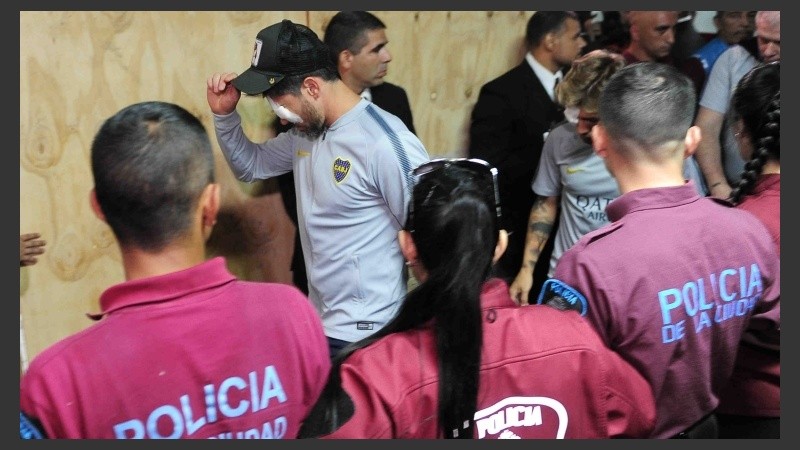 Pablo Pérez, uno de los jugadores más afectados por el ataque al micro de Boca.