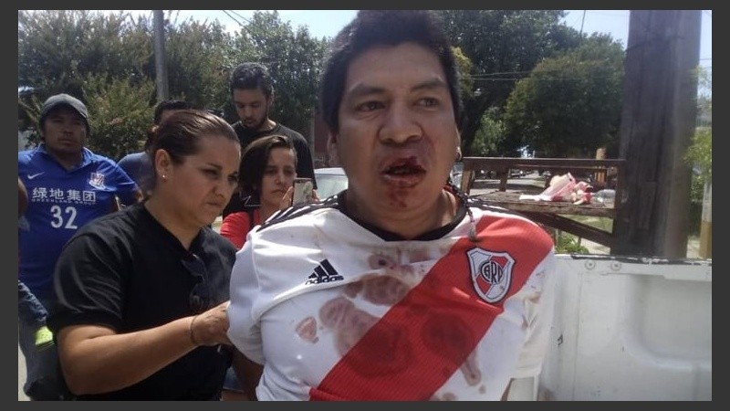 Las imágenes de algunos de los detenidos y lesionados en el barrio Toba.