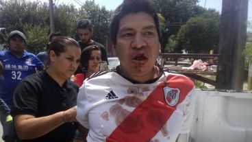 Las imágenes de algunos de los detenidos y lesionados en el barrio Toba.