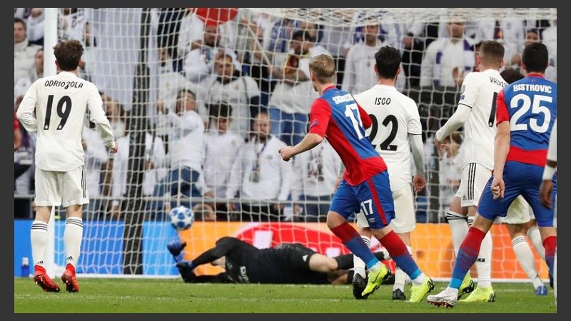 Volvió a destacar la fragilidad de Bale.