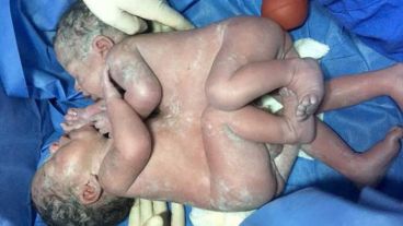 El curioso caso se registró en India.