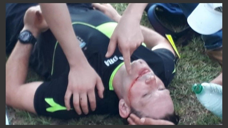 Así quedó el árbitro Cortíñez tras los golpes recibidos.
