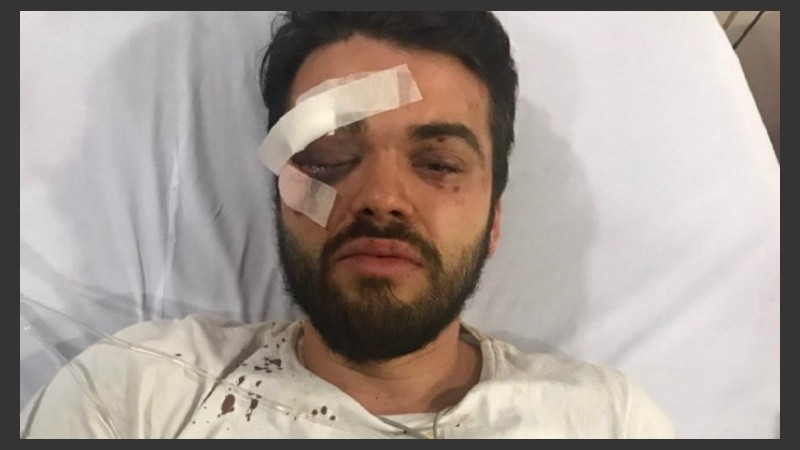 Así quedó Jonathan Castellari tras recibir la paliza.