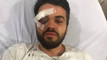 Así quedó Jonathan Castellari tras recibir la paliza.