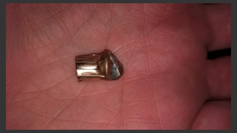 La bala que una familia de zona oeste encontró en el patio. 