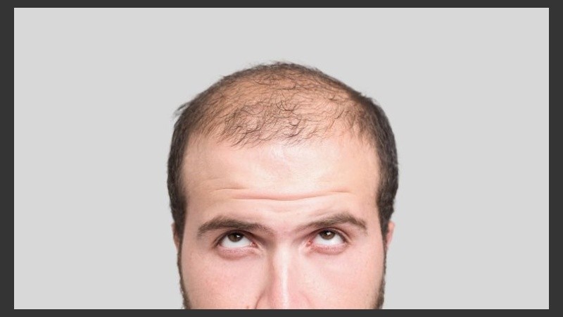 Lo normal es que cada día se pierdan entre 100 y 150 pelos.