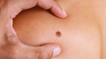 El trabajo fue publicado en una reconocida revista científica mundial.