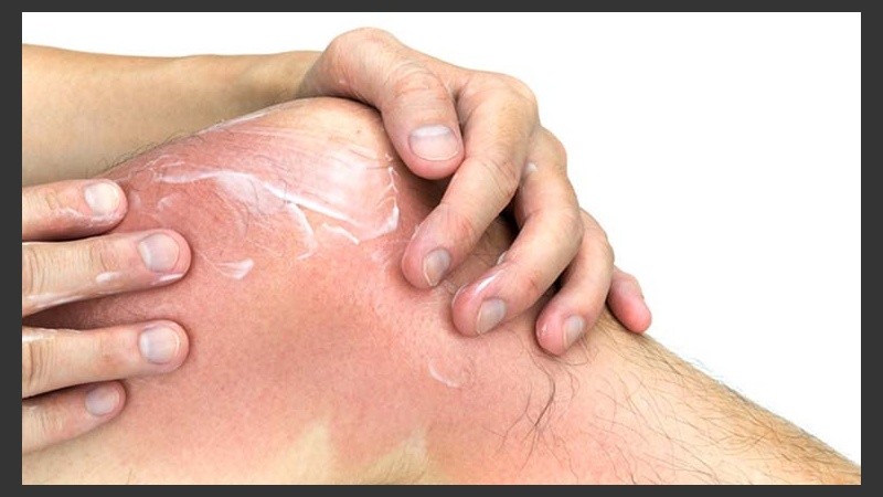 El streptococo se aprovecha cuando estamos con las defensas bajas.