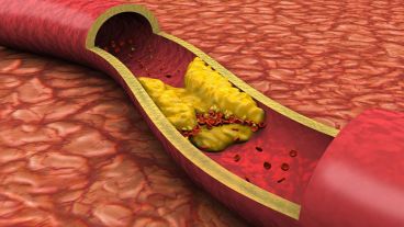 Representación de la forma en la que actúa el colesterol bueno.
