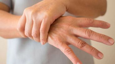 Los medicamentos tradicionales dejan de funcionar rápidamente con el "Parkinson juvenil".