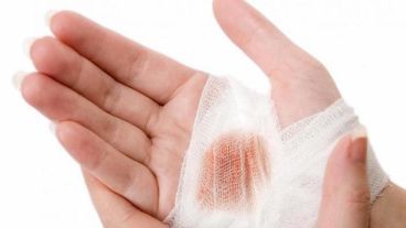 Las vendas ayudan a proteger la herida y que la infección se vuelva a producir.