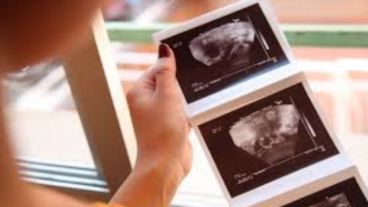 La posibilidad de acceder o no a un tratamiento de fertilización asistida está dada por un certificado.