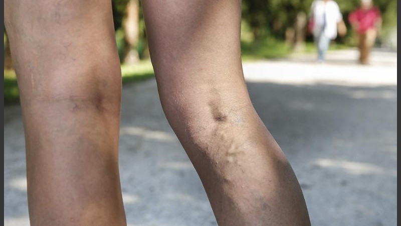 Lo primero que debemos hacer es el diagnóstico. 