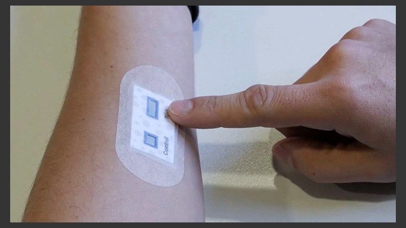 El parche cuenta con un circuito electrónico muy sencillo fácilmente imprimible.