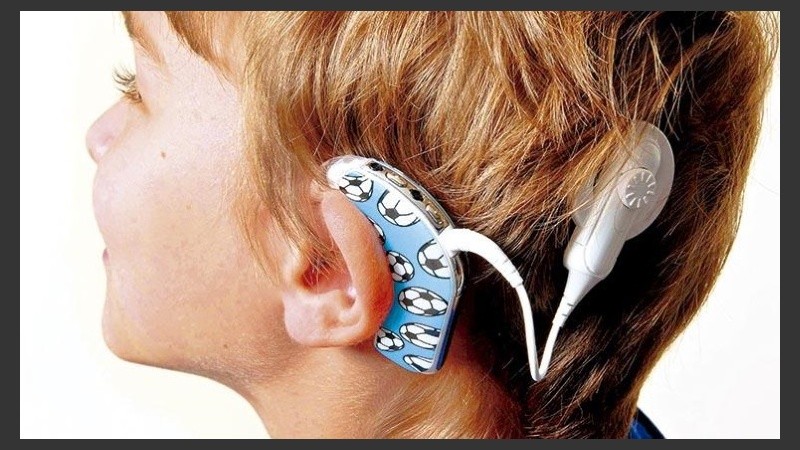 Detectar tempranamente la hipoacusia, nos permite equipar a los pacientes con audífonos si la pérdida auditiva así lo requiere.