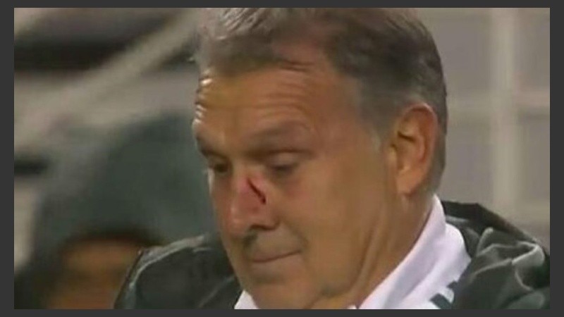 El Tata quedó cortado tras el pelotazo.