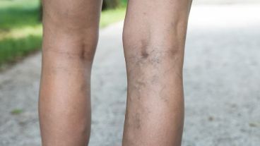 "Disponer del ecodoppler nos facilita el trabajo al brindarle al paciente la posibilidad en la misma entrevista de hacer el diagnóstico", sostiene Kuchen