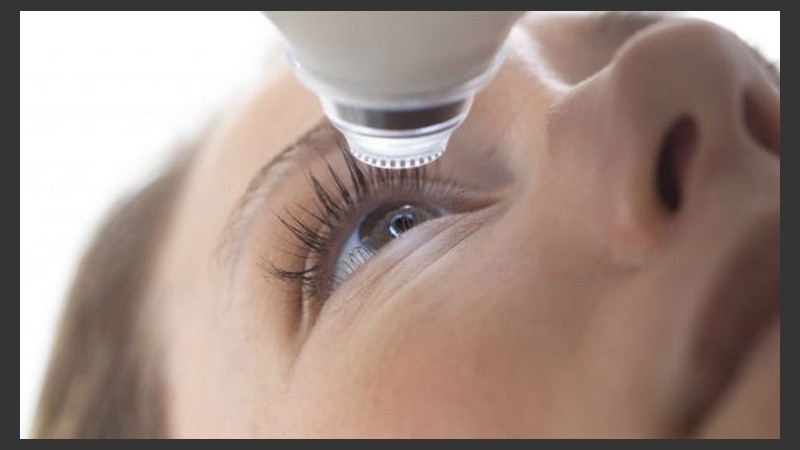 La catarata es la opacidad del cristalino