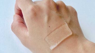 Estos adhesivos sirven no solo para lesiones cutáneas, sino también para heridas crónicas.