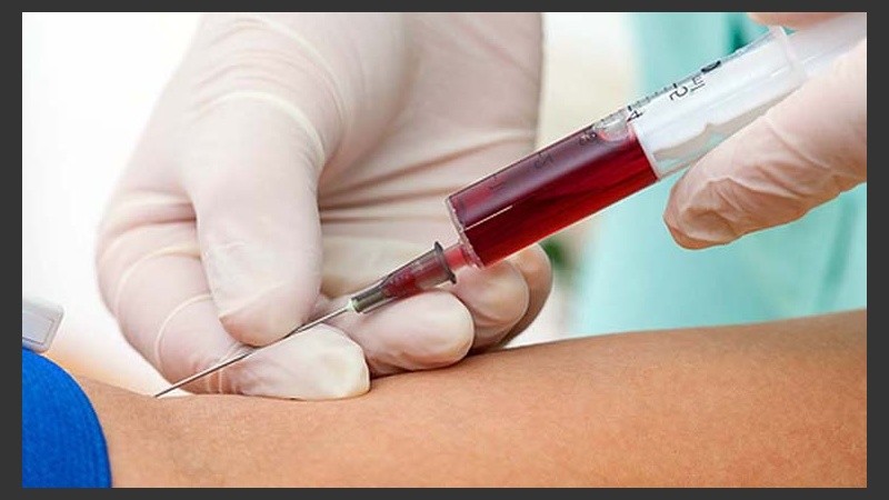 Estos resultados deben combinarse con la edad y la presencia de la variante genética APOE4.