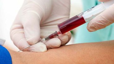 Estos resultados deben combinarse con la edad y la presencia de la variante genética APOE4.