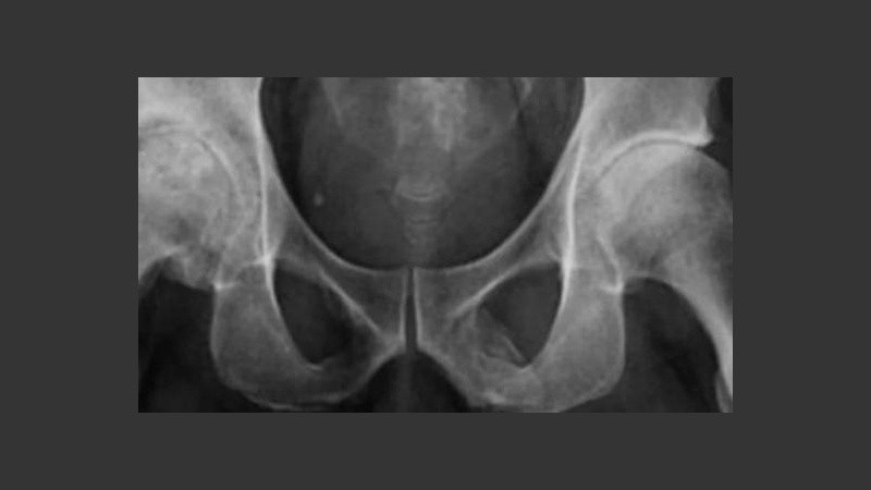 El caso es muy curioso y hay sólo 40 registros a nivel mundial. 