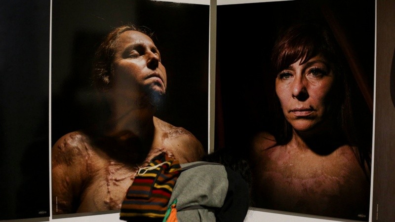 La muestra de fotoperiodismo más importante del país ya se puede ver en el Centro de Expresiones Contemporáneas.