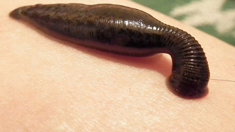  El niño ya fue dado de alta.