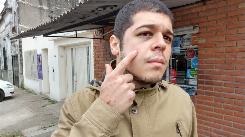 Pablo, el joven que sufrió extrema violencia en un robo. 