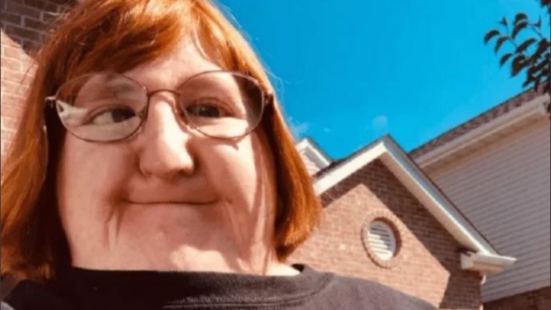 Melissa nació con la condición genética ósea y muscular del síndrome de 